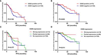 CD20 expression: A risk stratification factor for newly diagnosed multiple myeloma with t(11;14)